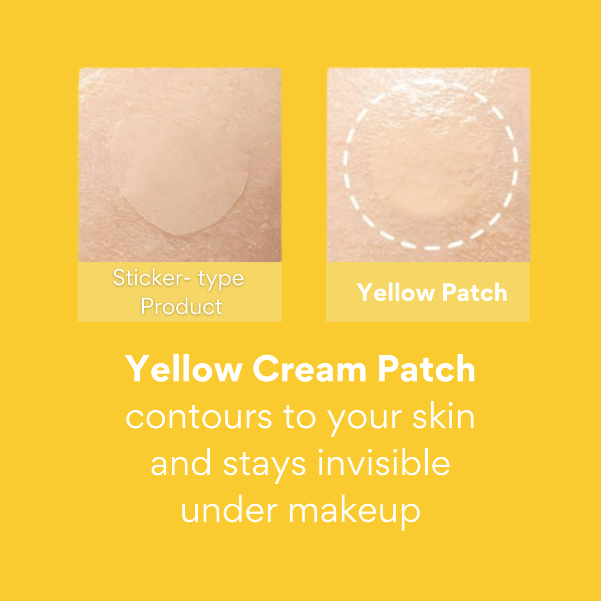 Yellow Cream Patch